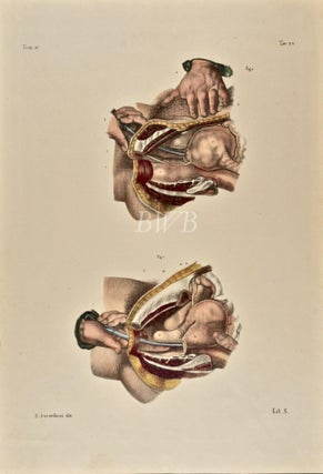 Item #618881 Malattie dell'utero [Diseases of the uterus]. Nicolas Henri Jacob, J. M. Bourgery