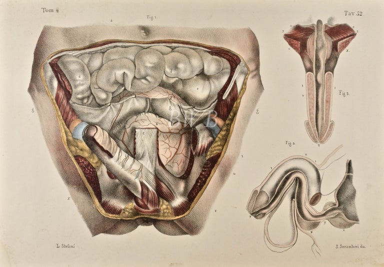 Item #618884 Anatomia chirurgica delle vie orinarie dell'uomo [Surgical anatomy of man’s urinary tract, 2]. Nicolas Henri Jacob, J. M. Bourgery.